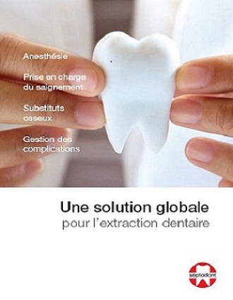 Une solution globale pour lextraction dentaire