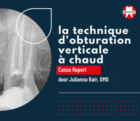 BioRoot Flow - Étude de cas sur l