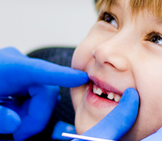 Bouche souriante dun enfant chez le dentiste - gérer la douleur du patient