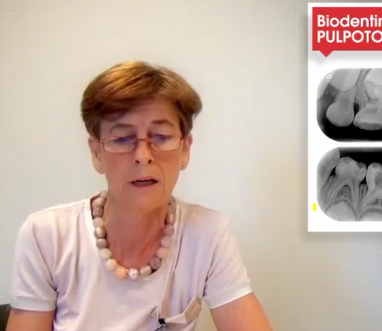 Webinar Rita Cauwels - La Biodentine chez le jeune patient