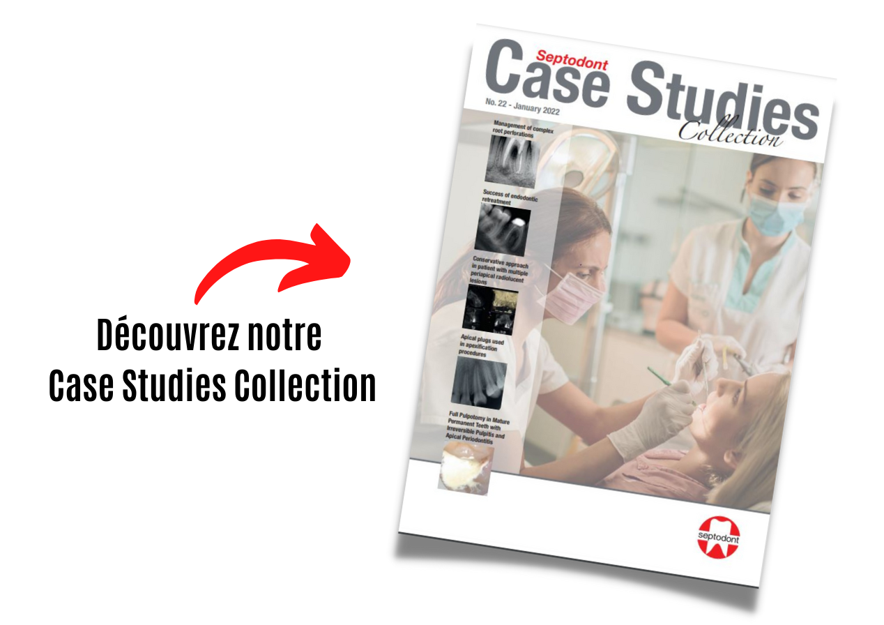Case Studie Collection n°22 annonce